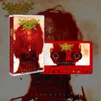 Monochromatic Black - Vehemence CASSETTE